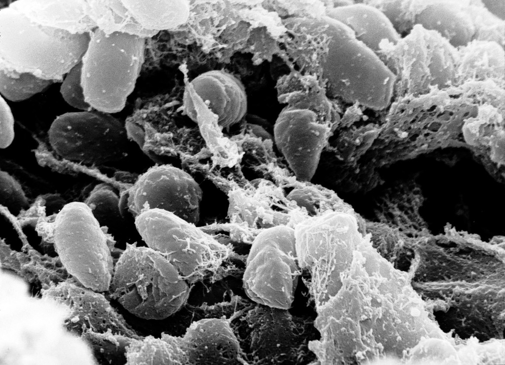 Il bacillo della peste: Yersinia pestis